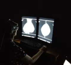 mammogram ORNL Oak Ridge National Laboratory eye-tracking
