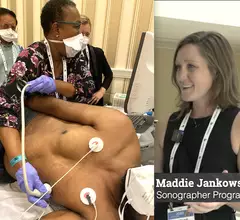 Video of Maddie Jankowski explaining sonographer highlights and trends at the American Society of Echo (ASE) 2023 meeting.