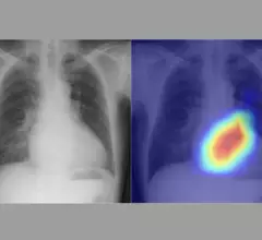 Artificial intelligence (AI) model using chest x-rays to evaluate cardiac function