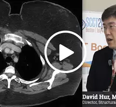 Video of David Hur discussing how to overcome technical challenges in cardiac CT, which he presented on in sessions at SCCT 2023.