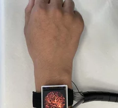 photoacoustic imaging watch