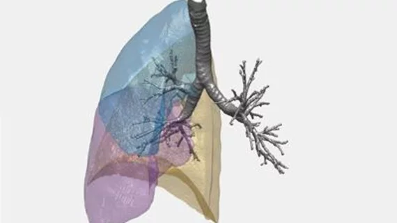 18_97_illustration_of_lung_structure_from_ct_scan_data_credit_university_of_southampton_web.jpg_sia_jpg_fit_to_width_inline.jpg