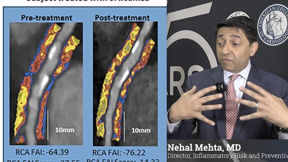 Interview with Nehal Mehta, MD, University of Pennsylvania, who explains how coronary inflammation can be seen using AI on cardiac CT scans to better risk stratify patients and begin preventive drug therapy.
