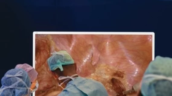 Olympus Big Screen 4K Surgery