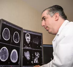 Goldberg MRI stroke brain