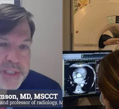 Eric Williamson, MD, MSCCT, the president of the Society of Cardiovascular Computed Tomography (SCCT) and professor of radiology at Mayo Clinic, explains how the iodine contrast shortage is causing issues for cardiac CT imaging. He discusses ways imagers can stretch they iodine contrast supplies and some technologies that might help conserve contrast. #contrastshortage