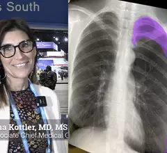 Video interview with Nina Kottler, MD, MS, associate chief medical officer for clinical AI, Radiology Partners, explains what radiology practices should consider when assessing artificial intelligence (AI) return on investment in an era where there is little reimbursement. #RSNA #RSNA23 #RSNA2023 #HealthAI #AIhealthcare