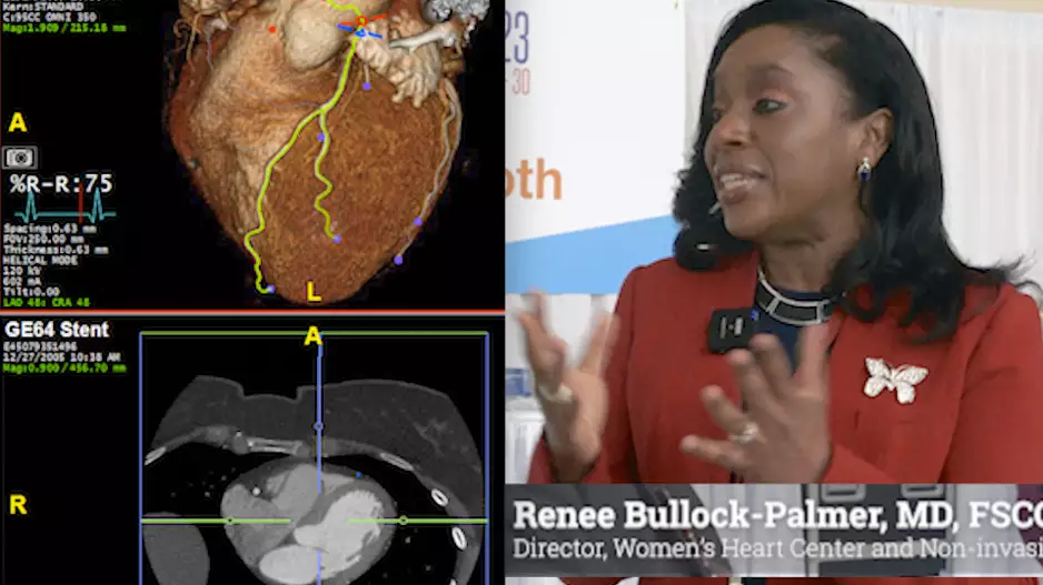 Video of Renee Bullock-Palmer, MD, FSCCT, director, Women’s Heart Center, and director, non-invasive cardiac imaging, at the Deborah Heart and Lung Center in Browns Mills, New Jersey, explaining the latest guidelines that support use of CT angiography at SCCT 2023. #YesCCT #CCTA #CTA #SCCT #SCCT23 #SCCT2023