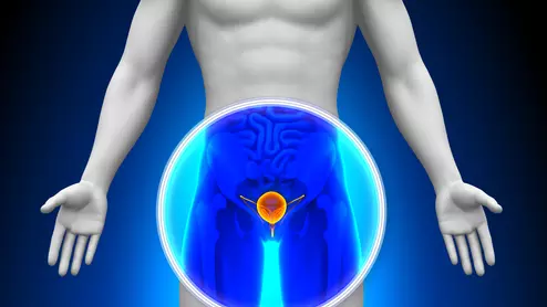 scan of prostate