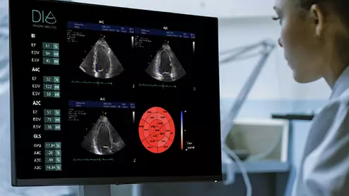 DiA Imaging Analysis, which specialized in developing the AI-based automated cardiac ultrasound solution LVivo Seamless. The technology is now integrated through partnerships with dozens of healthcare vendors, including ScImage, GE Healthcare, Philips Healthcare Konica Minolta and IBM Watson.