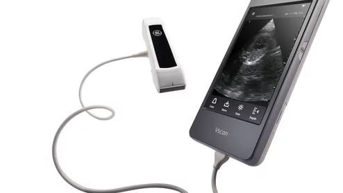POCUS hand-held ultrasound using the GE Vscan Extend. GE RSNA PR image