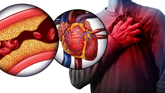 A heart attack is caused when one of the coronary arteries becomes blocked with a clot.