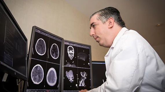 Goldberg MRI stroke brain
