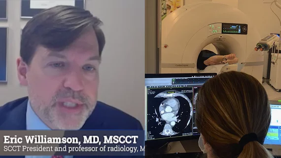 Eric Williamson, MD, MSCCT, the president of the Society of Cardiovascular Computed Tomography (SCCT) and professor of radiology at Mayo Clinic, explains how the iodine contrast shortage is causing issues for cardiac CT imaging. He discusses ways imagers can stretch they iodine contrast supplies and some technologies that might help conserve contrast. #contrastshortage