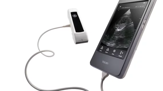 POCUS hand-held ultrasound using the GE Vscan Extend. GE RSNA PR image